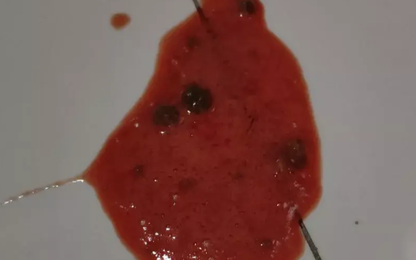 Cats vomit red liquid and foam, so pay attention to it!
